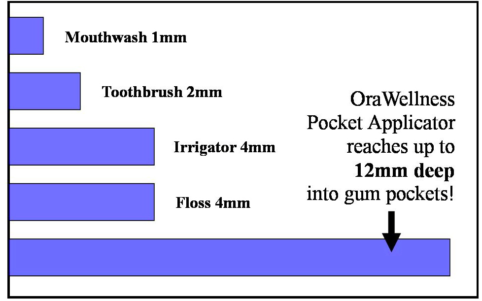 Dental Pocket Depth Chart